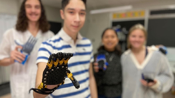 Des lycéens construisent une main robotique pour un camarade de classe et changent leur vie