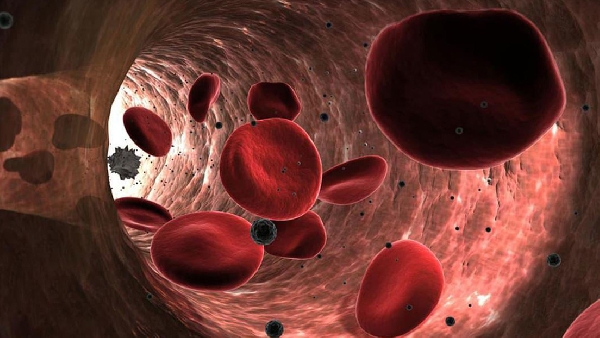 Des microplastiques découverts pour la première fois dans des vaisseaux sanguins humains